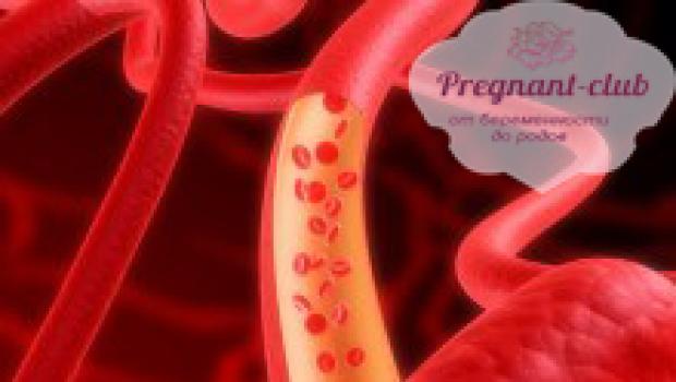 Нарушение кровотока при беременности